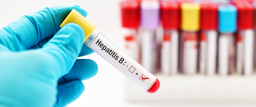 Wat is hepatitis B? Wat is die simptome en behandelingsmetodes?